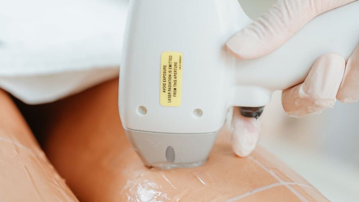 Séance d'épilation à la lumière pulsée, l'applicateur posé sur la peau recouverte de gel